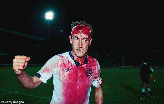 Butcher – nach seinem Spiel gegen Schweden 1989 mit einem blutigen England-Trikot abgebildet – sagt, dass Kopfball „etwas ist, auf das wir verzichten können“