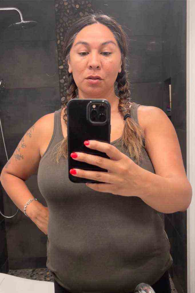 Adriana Rodriguez macht ein Selfie, das unerwünschte Beulen an ihrem Körper zeigt.  Sie behauptet, sie seien das Ergebnis von CoolSculpting-Sitzungen, die sie insgesamt 9.000 US-Dollar gekostet haben.