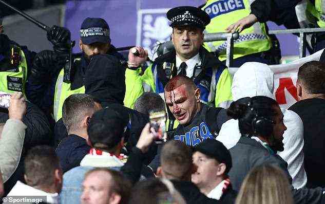 Ein Ungarn-Fan wird nach den Zusammenstößen mit der Polizei in Wembley am Kopf bluten gesehen