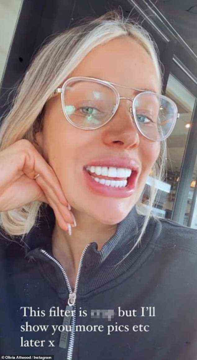Pearly Whites: Dies kommt, als Olivia am Samstag ihren 1,9 Millionen Instagram-Followern ihre neuen Zähne zeigte