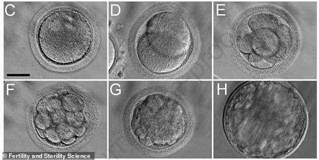 Die Forscher nutzten embryonale Stammzellen von Rhesusaffen, um unreife Spermien, sogenannte runde Spermatiden, zu erzeugen, die keinen Kopf und keinen Schwanz zum Schwimmen haben, weil sie sich in einem früheren Stadium ihrer Entwicklung befinden.  Es wurde gezeigt, dass diese Spermatiden in der Lage sind, ein Rhesus-Makaken-Ei zu befruchten (im Bild)