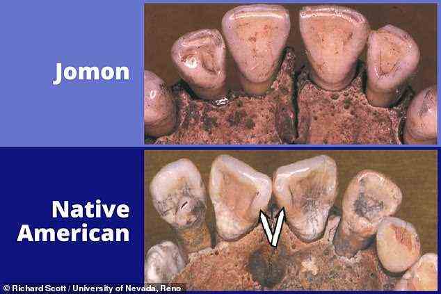 Entgegen der landläufigen Theorie stammen die Vorfahren der amerikanischen Ureinwohner nicht aus Japan, ergab eine Studie über 15.000 Jahre alte menschliche Zähne und Genetik.  Im Bild: Beispiele von Zähnen, die in der Studie analysiert wurden, die Exemplare des alten Jäger-Sammler-Fischer-Volkes 