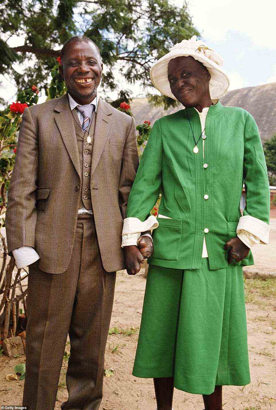 A sunday morning scene taken by Stoddart in 1989 at Mutemwa Leprosy Settlement in Zimbabwe as lepers William Padzuru and Maria Majhu pose for the camera together after their wedding