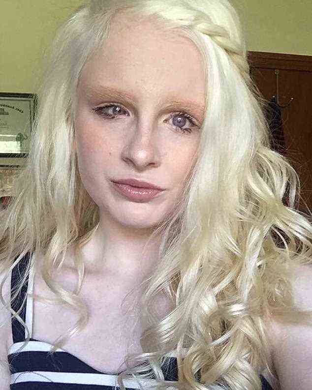 Eine Albino-Frau ist dank ihrer unglaublichen violetten Augen auf TikTok viral geworden