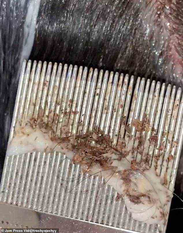 Rachel Maroun, 21, aus Sydney, Australien, arbeitet in einer Läuseklinik und war schockiert, als ein 13-jähriges Mädchen hereinkam, das „mehr Läuse als Haarsträhnen“ hatte.  Als sie sie kämmte, kamen die Läuse in 