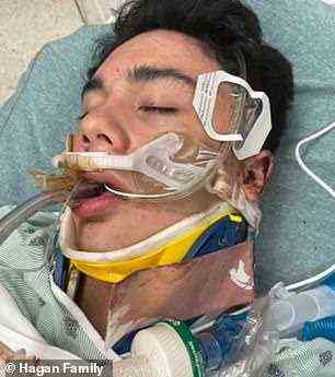 Der 16-jährige Teenager wurde mehrere Tage lang an ein Beatmungsgerät gelegt, bevor er selbst atmen konnte