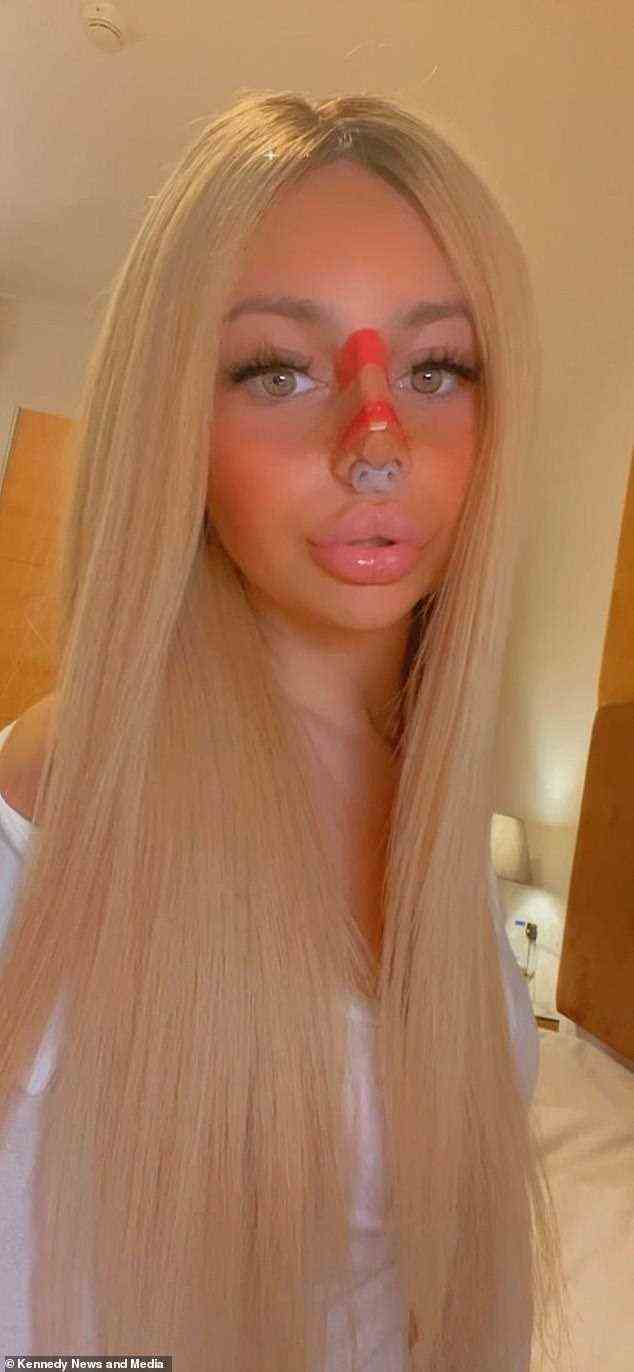 The young woman had to hit back at online trolls who accused her of 'assault' after she revealed that she usually doesn't disclose that she's trans in nightclubs in a TikTok video. Pictured recovering from a rhinoplasty
