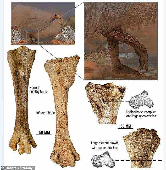 Der Fund von Forschern der Flinders University enthüllte schwere Knocheninfektionen in mehreren Dromonithiden-Überresten, die in den 160 km² großen Betten des Fossilienreservats Lake Callabonna, 600 km nordöstlich von Adelaide, versunken sind