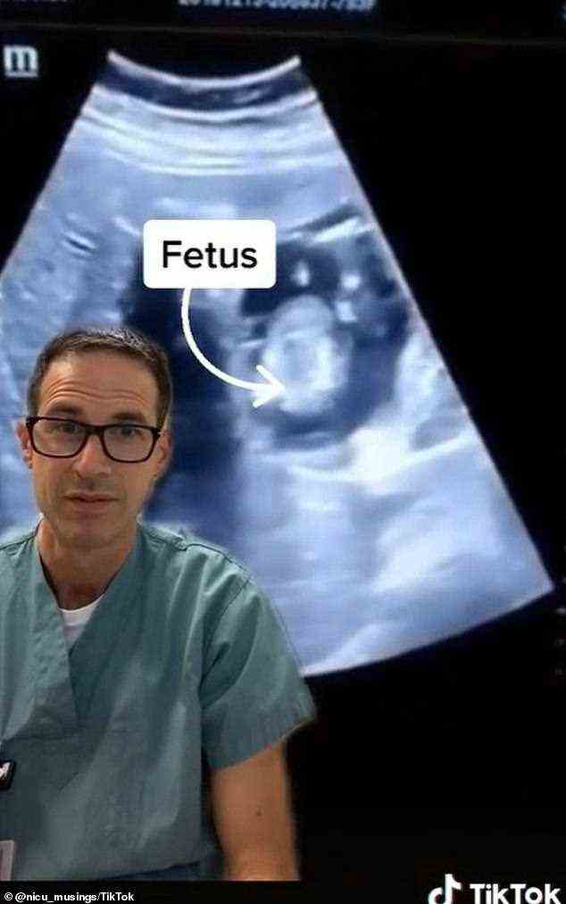 Ärzte stellten eine Eileiterschwangerschaft in der Leber einer Frau fest.  Im Bild: Dr. Michael Narvey teilt den Fall auf TikTok und zeigt ein Sonogramm des in die Leber eingebetteten Fötus