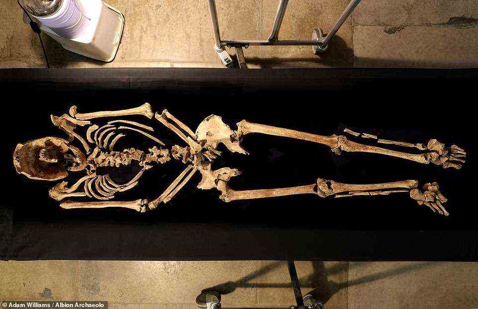 Überreste eines römischen Sklaven (im Bild) mit einem fünf Zentimeter langen Eisennagel, der durch sein Fersenbein getrieben wurde, wurden in Cambridgeshire gefunden – und sind das „weltbeste Beispiel für Kreuzigung“