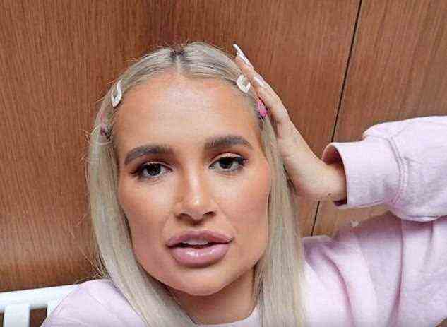Last year Love Island contestant Molly-Mae Hague, 22, boasted she had spent thousands having procedures, including jaw and lip fillers, reversed