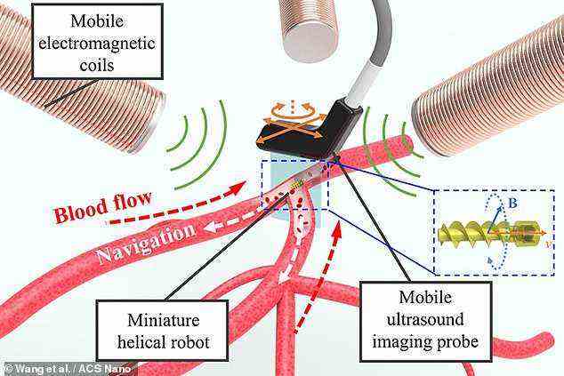 Blutgerinnsel könnten bald beseitigt werden, indem mikroskopisch kleine Roboter mit schraubenähnlichen Propellern eingesetzt werden, die durch Blutgefäße schwimmen, die blockierende Medikamente enthalten.  Der winzige Roboter und sein Propeller werden durch das Anlegen eines externen Magnetfelds angetrieben – und er ist in der Lage, sich mit und entgegen der Blutflussrichtung zu bewegen