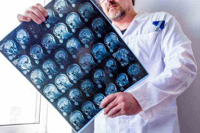 Der Arzt untersucht den MRT-Scan von Kopf, Hals und Gehirn des Patienten