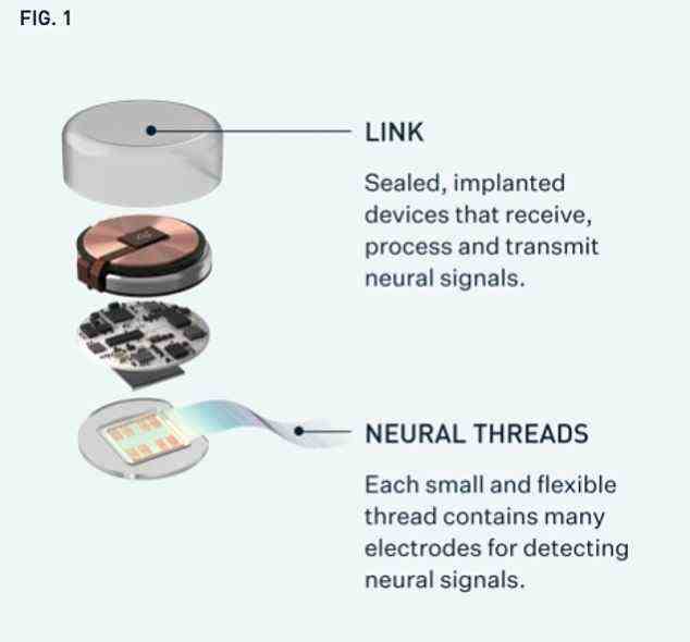 Neuralink's system is comprised of a computer chip attached to tiny flexible threads that are stitched into the brain by a 'sewing-machine-like' robot. The device pickups signals in the brain, which are then translated into motor controls