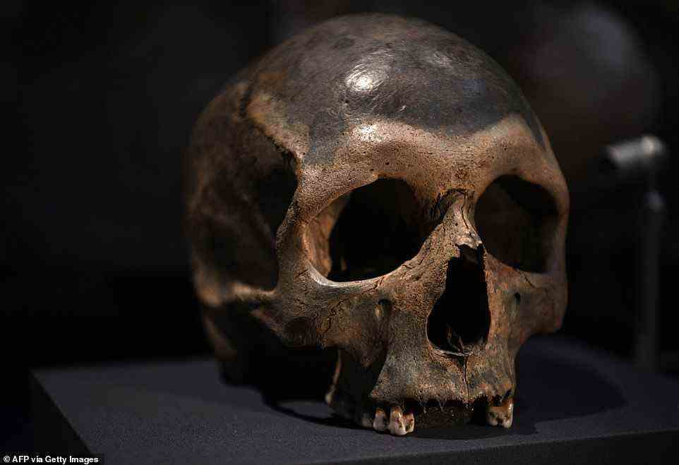 A human skull showing healed blunt force trauma on the forehead. The skull is one of several examples of ancient human bones that are on display in the new exhibition