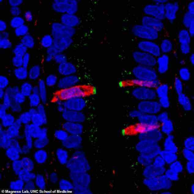 Forscher färbten Proteine ​​im Dünndarm fluoreszierend.  Sie fanden heraus, dass CFTR, ein Gen, das an Mukoviszidose beteiligt ist (grün gefärbt), und FKBP1A, ein Ziel von Arzneimitteln, die Immunzellen beeinflussen sollen (rot gefärbt), beide in einem Zelltyp innerhalb der menschlichen Darmschleimhaut vorhanden sind, was ihre Ergebnisse bestätigt die Einzelzell-Gensequenzierung
