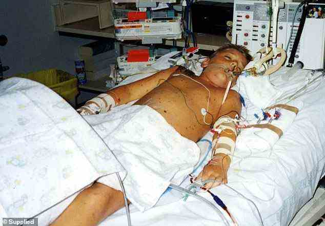 Brenden Hall im Krankenhausbett: Hall musste sein Bein amputiert werden, er wusste es erst, nachdem es passiert war