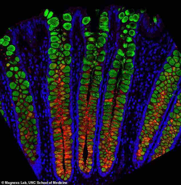 Durchbruch: Wissenschaftlern ist es erstmals gelungen, den menschlichen Darm mit Einzelzellauflösung zu kartieren (Bild).  Sie erhoffen sich davon wichtige Erkenntnisse zu Darmerkrankungen