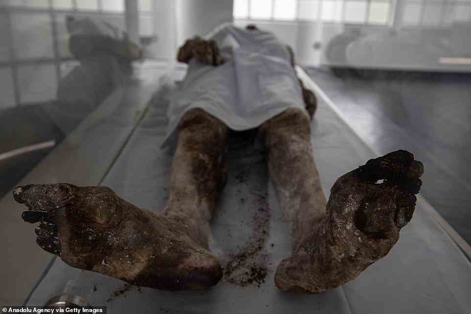 Close-up of the legs and feet of the same mummy. Preservation of the toes appears to be slightly better on the deceased's left foot