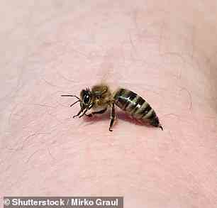 Um Bienenstiche zu behandeln, entfernen Sie den Stachel mit einer Pinzette und spülen Sie ihn mit Wasser ab, bevor Sie Eis auftragen