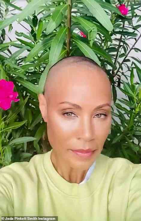Journey: She also spoke about her journey with alopecia on a September 2021 episode of Red Table Talk with Tiffany Haddish and Yvonne Orji, telling the the decision to shave her head came from, 'that kind of expression and release"'