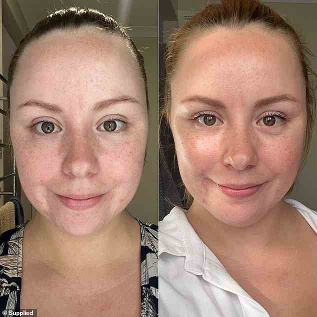 Vorher und nachher: ​​Schönheitsliebhaber schwärmen von den aufhellenden Niacinamid-Seren der australischen Hautpflegemarke Sabbia Co, nachdem sie die Ergebnisse in nur fünf Tagen gesehen haben