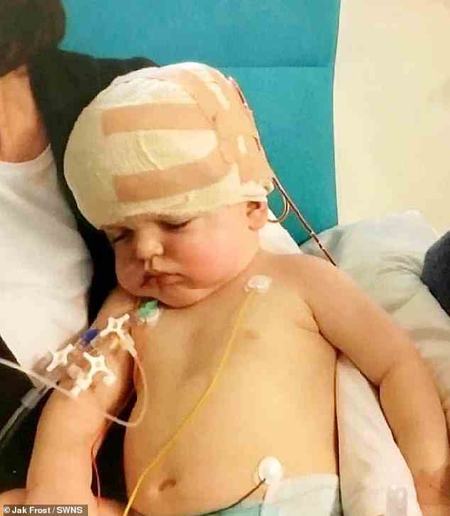 Bei Daniel Bradley (Bild 2012) aus Alfreton in Derbyshire wurde im Alter von drei Monaten eine seltene Kraniosynostose diagnostiziert, die nur eines von 2.500 Babys betrifft.  Es wird verursacht, wenn Gelenke im Schädel miteinander verschmelzen, was bedeutet, dass nicht genügend Platz für das Wachstum des Gehirns vorhanden ist