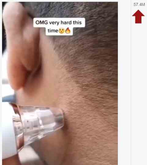 Facebook-Video eines Mannes, der einen Maulwurf an seinem Hals reißt