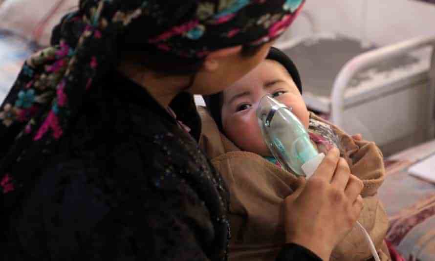 In Kabul wird ein Kind mit Masern behandelt. 