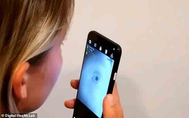 Wissenschaftler haben eine Smartphone-App entwickelt, von der sie behaupten, dass sie Anzeichen von Alzheimer und anderen neurologischen Erkrankungen erkennen könnte – basierend auf einem Selfie des Auges