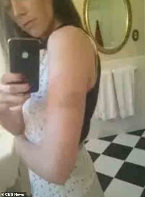 Amber Heard took a photo of a bruise on her arm in March 2013