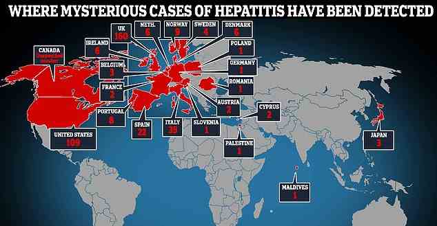 Seit April wurden in 21 Ländern rund 350 Fälle von „schwerer Hepatitis unbekannter Ursache“ bei Kindern registriert