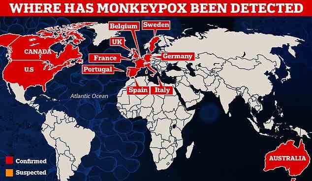 Eleven countries ¿ including the US, Spain and Italy ¿ have now detected monkeypox, in the first global outbreak of its kind