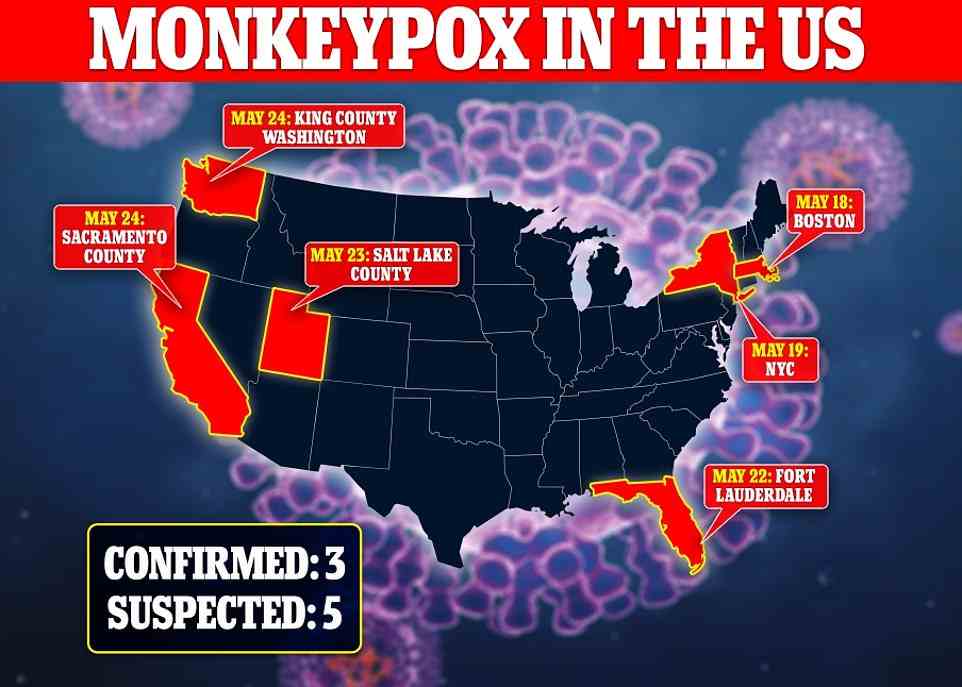 Utah yesterday revealed its two reported cases of monkeypox had been confirmed, raising the tally to three confirmed cases. There are five suspected cases in the country