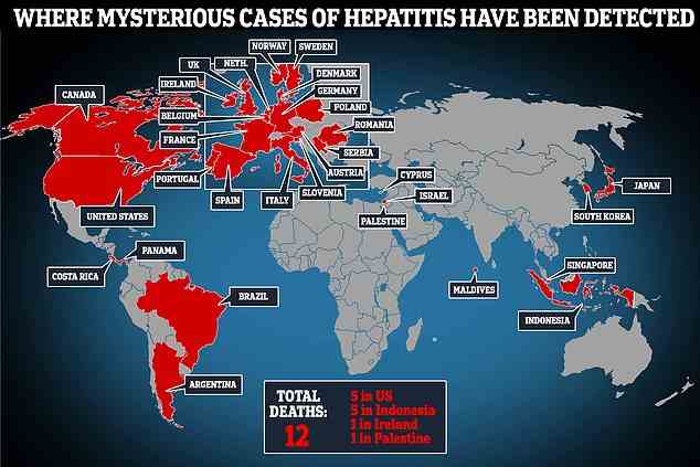 Die mysteriöse Hepatitis wurde in den USA, Westeuropa und einer Handvoll anderer Länder entdeckt.  Weltweit sind mindestens 12 Jugendliche gestorben und Dutzende benötigten Lebertransplantationen