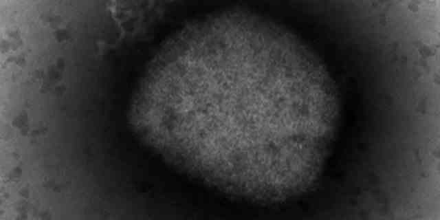 Auf diesem Foto, das von der Unidad de Microscopía Electrónica del ISCIII in Madrid am Donnerstag, den 26. Mai 2022, zur Verfügung gestellt wurde, zeigt ein elektronisches Mikroskopbild das Affenpockenvirus.