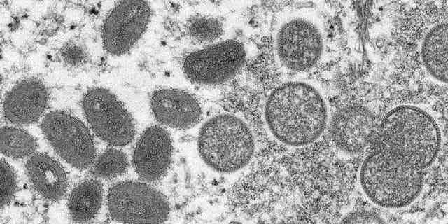 Dieses elektronenmikroskopische Bild aus dem Jahr 2003, das von den Centers for Disease Control and Prevention zur Verfügung gestellt wurde, zeigt reife, ovale Affenpocken-Virionen (links) und kugelförmige unreife Virionen (rechts), die aus einer Probe menschlicher Haut im Zusammenhang mit dem Präriehund-Ausbruch von 2003 gewonnen wurden. 