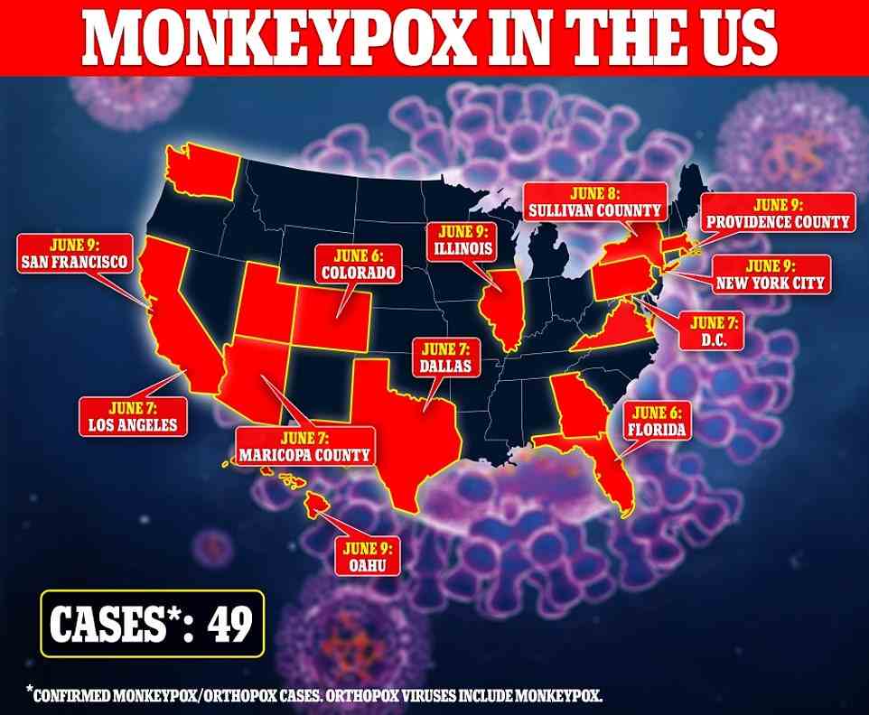 Insgesamt 49 Fälle von Affenpocken wurden inzwischen in 15 Staaten in Amerika und Washington DC registriert. Die Centers for Disease Control and Prevention sagen, dass die meisten Fälle bei Menschen auftreten, die kürzlich aus dem Ausland zurückgekehrt sind