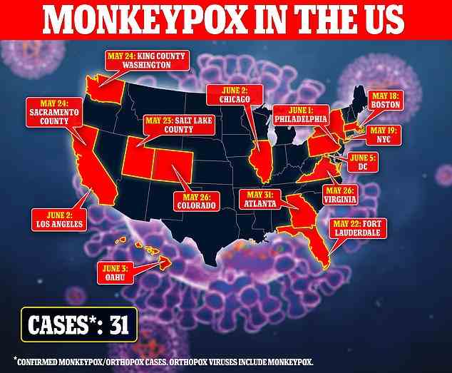 Amerika hat jetzt 31 Fälle von Affenpocken in 12 Bundesstaaten und Washington DC bestätigt
