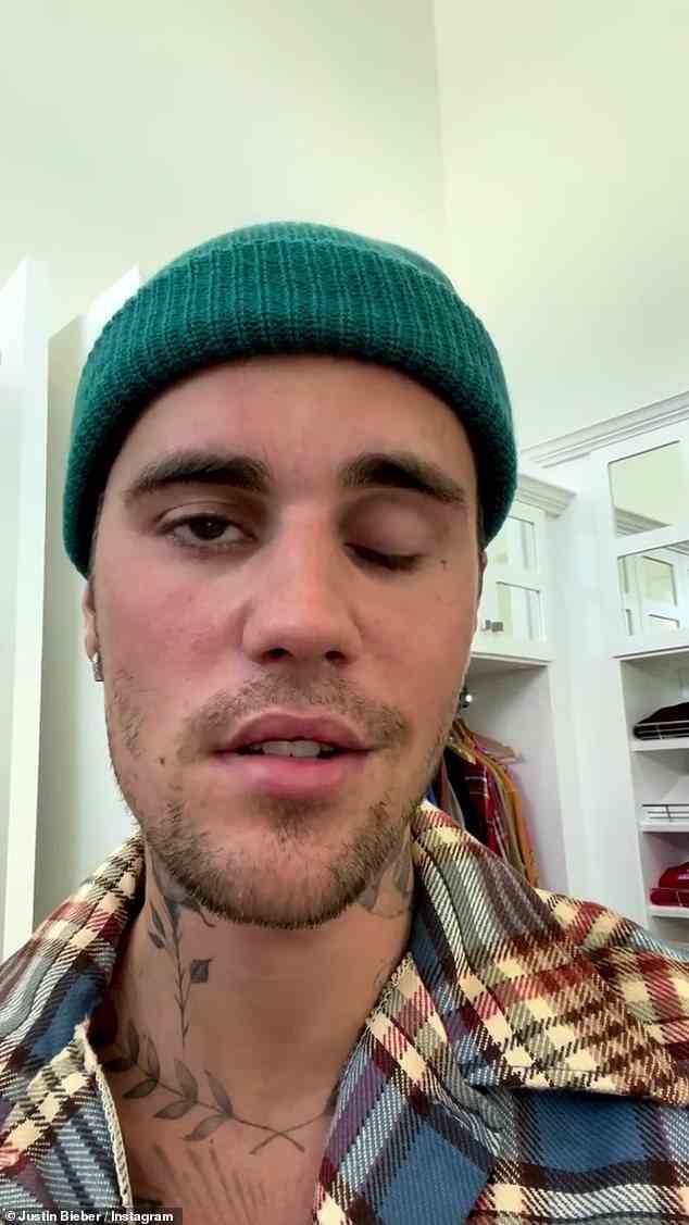 Sad news: Justin Bieber has revealed that he has suffered facial paralysis from Ramsay Hunt syndrome just days after cancelling dates on his Justice World Tour, as he said that he cannot blink or move the right side of his face