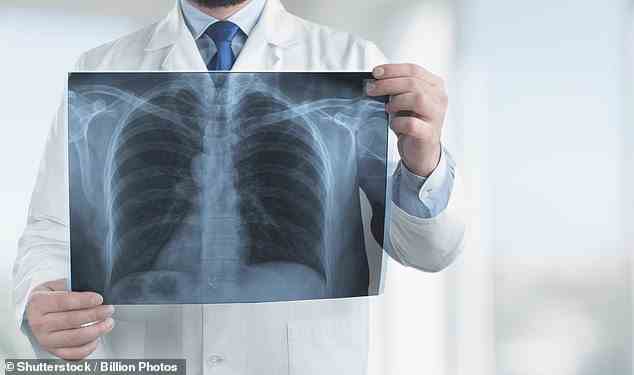 Menschen mit Erkrankungen wie Asthma, Virusinfektionen, Mukoviszidose und chronisch obstruktiver Lungenerkrankung (COPD) – ein Überbegriff für chronische Lungenerkrankungen, einschließlich Emphysem – können zu viel Schleim produzieren