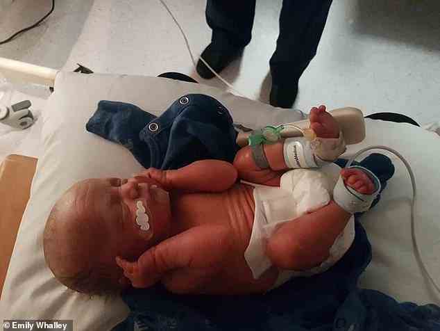 Henry (als Neugeborenes abgebildet) wurde mit 31 Wochen mit mehreren gesundheitlichen Komplikationen geboren