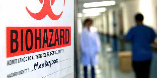 Ein Warnschild an der Tür des Labors, in dem der erste Schritt beim Testen von Proben auf Affenpocken im Veterinärdiagnostiklabor der Universität von Minnesota unternommen wird.