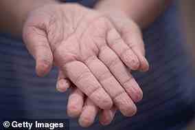 Forscher glauben, dass faltige Hände im Wasser ein evolutionärer Vorteil sind