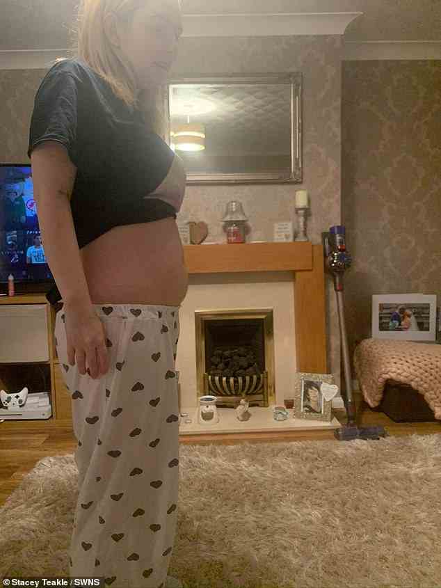 Eine hagere und schwache Stacey Teakle ist im fünfeinhalb Monat schwanger und immer noch von ständiger Übelkeit geplagt