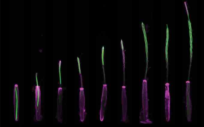 Fluoreszenzmikroskopische Aufnahme eines Seeanemonenstachels, der sich während des Stichvorgangs ausdehnt
