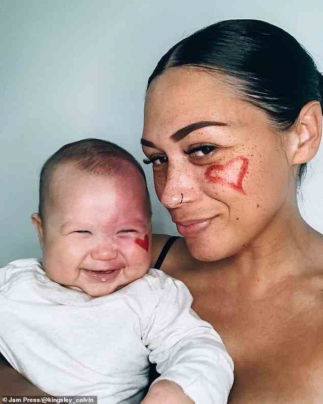 Eine australische Mutter hat enthüllt, dass sie von grausamen Trollen als „Monster“ bezeichnet wurde, weil sie sich entschieden hatte, das Muttermal ihres Babys im Gesicht abzulasern – behauptet aber, sie habe es getan, um ihrem Kind zu helfen