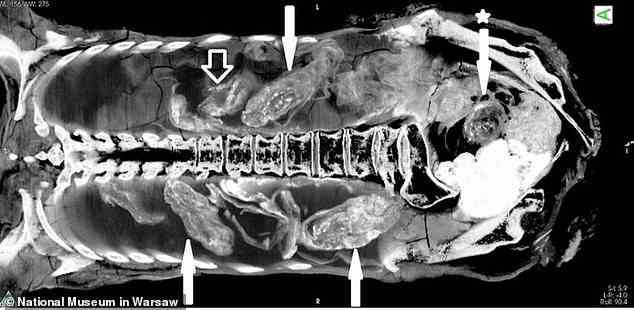 Einige Experten des Warschauer Mumienprojekts behaupten, dass das, was auf Röntgen- und CT-Bildern wie ein Fötus aussah, tatsächlich „eine Computerillusion und Fehlinterpretation“ war.  Sie sagen, dass einige der hier mit Pfeilen abgebildeten Objekte fälschlicherweise als fötaler Kopf und Körper identifiziert wurden