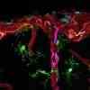 Dieses zeigt Gewebemakrophagen in einem Mausgehirn