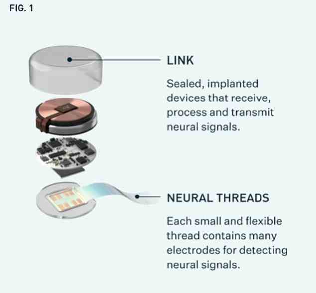 Das System von Neuralink besteht aus einem Computerchip, der an winzigen flexiblen Fäden befestigt ist, die von einem „nähmaschinenähnlichen“ Roboter in das Gehirn genäht werden.  Das Gerät nimmt Signale im Gehirn auf, die dann in motorische Steuerungen übersetzt werden